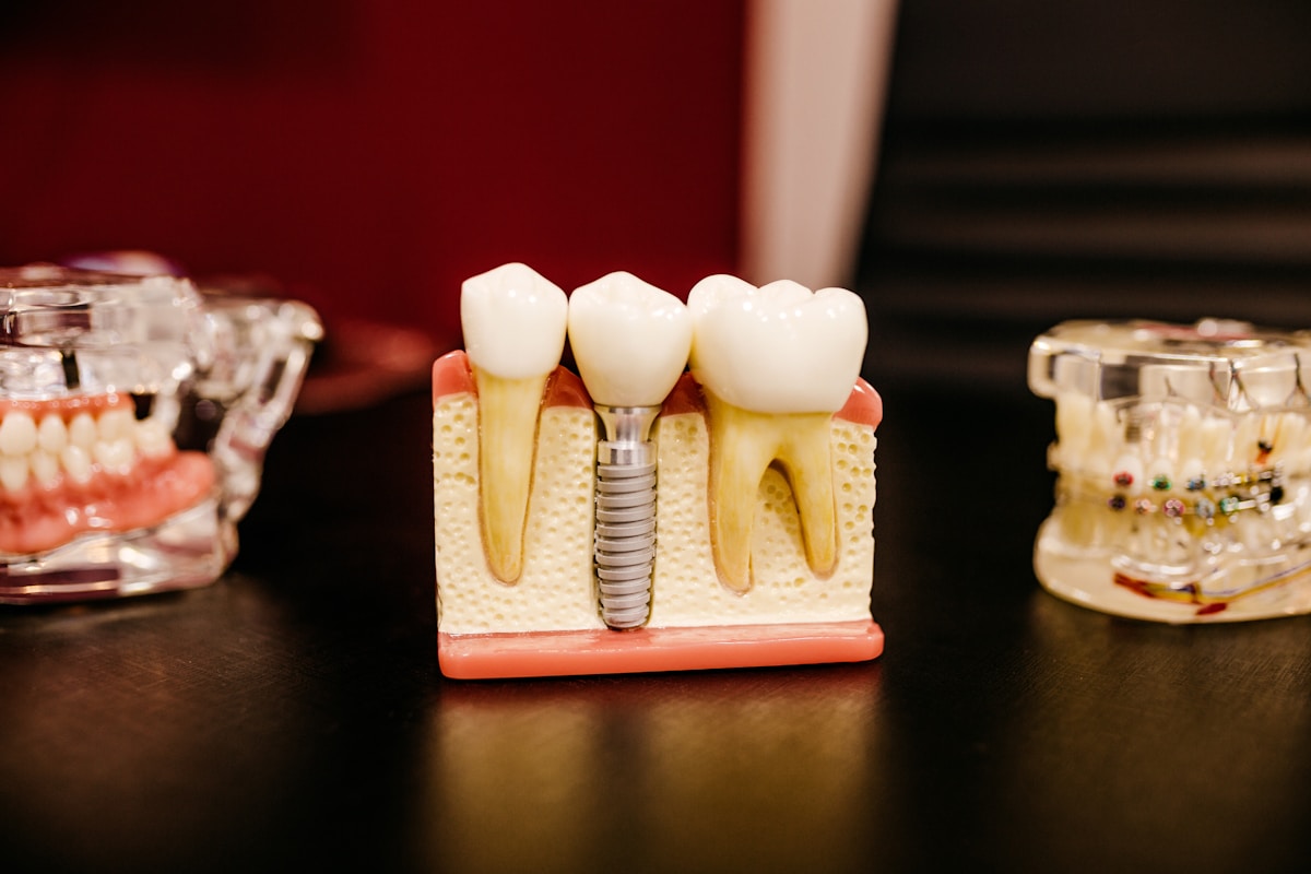 AI Smile Design